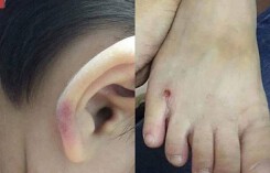 Con bị mẹ kế đánh đến nhập viện: 'Nén đau xót để quay làm bằng chứng'