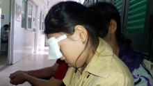 Vụ học sinh bị bạn ném bút bi hỏng mắt: Nhà trường lên tiếng